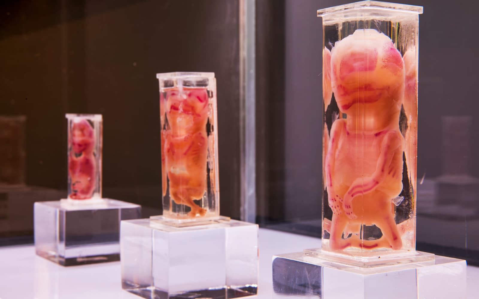 Skip-the-Line Tickets to the Human Bodies Exhibition with Audio Guide in Barcelona - Discover | TickYourList